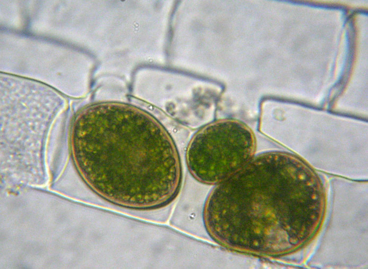 Alghe 3: Spirogyra sp